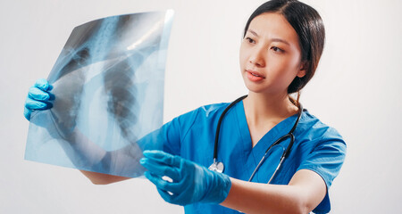 Medical diagnostics. Chest x-ray. Woman doctor studying lungs radiography result in hand...