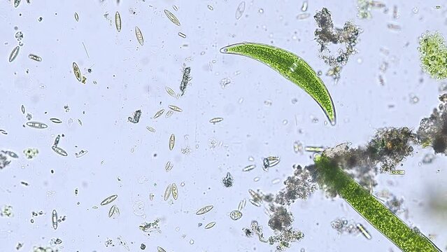Closterium and diatom algae from a river under the microscope - optical microscope x200 magnification