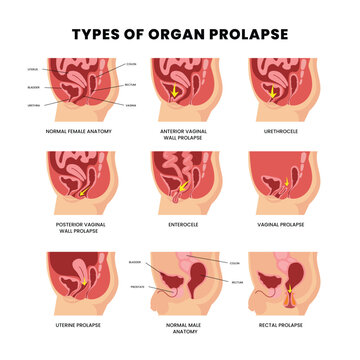 Royxatdan holda onam bilan porno video