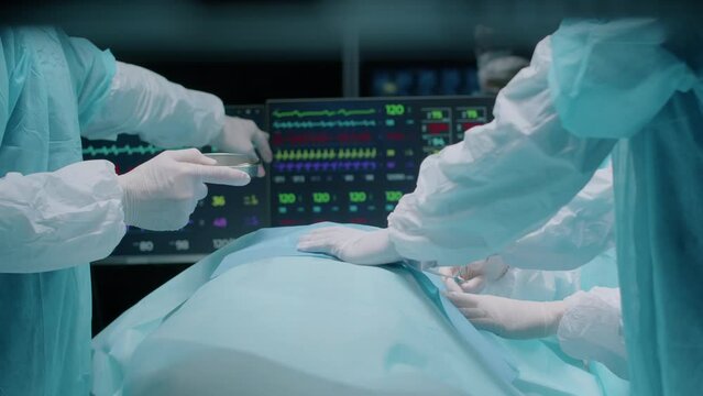 Cropped shot of unrecognizable professional team on surgeon and two assistants checking up vital signs of patient on monitor while performing operation