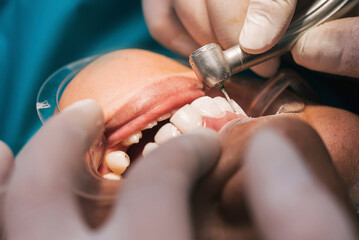 Mouth of female patient during orthodontic procedure