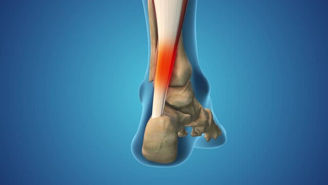 Sprained ankle pain and swollen inflammation