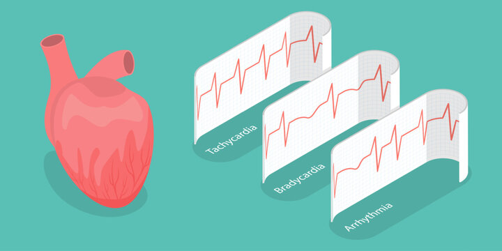 3D Isometric Flat Vector Illustration of Pathological Heart Rhythm Types, Electro-cardiogram