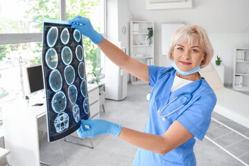 Female doctor studying MRI scan at hospital