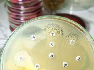 Antibiotic susceptibility testing,  antibiotic resistance.