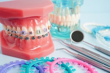 Orthodontic ligatures rings and ties, elastic rubber bands on orthodontic braces, model for dentist...