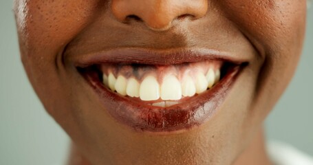 Person, african and closeup with teeth, smile and dental care and oral hygiene or health. Mouth,...