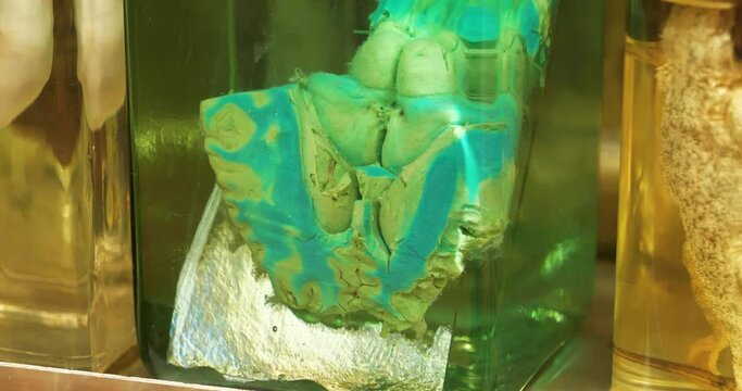 Cattle brain. Blue cow brain in flask. Anatomy of brain, convolutions of brain, gyri of cerebrum. Animal brain in glass jar with formaldehyde for medical research. Sectional view of a cattle brain