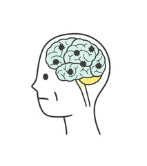 レビー小体型認知症によって損傷を受ける脳の部分のイラスト
