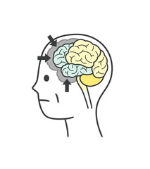 前頭側頭型認知症によって損傷を受ける脳の部分のイラスト
