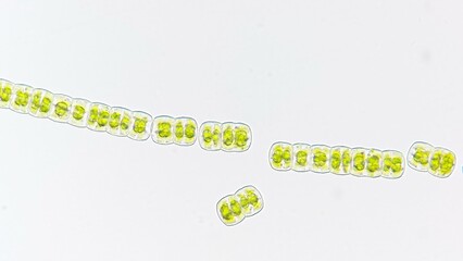 Freshwater filamentous algae, Hyalotheca sp. Selective focus image
