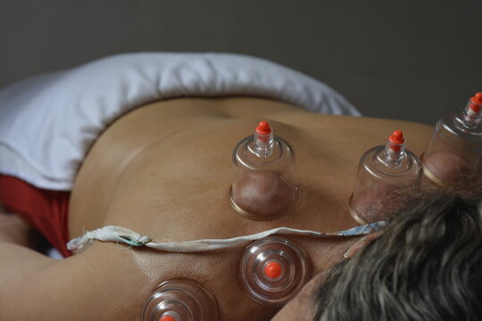 Ventosa para tratamento e alivio de dores
