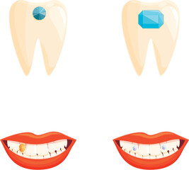 Dental jewelry icons set cartoon vector. Human tooth decorated with gem. Aesthetic dentistry