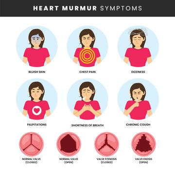 Heart murmur symptoms infographic medical poster design, labeled Cardiology, endocarditis disease, endocardium infection in heart chambers and valves, anemia and murmur, chest acute pain.