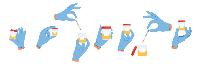 Set of illustrations with urine analysis. Doctor hands in blue gloves hold containers with pee sample