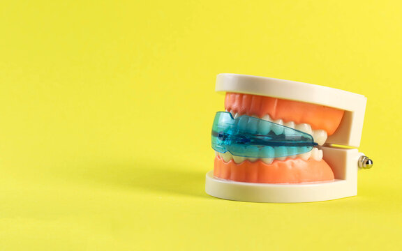 Dental mouth guard for bruxism with a mock-up of a dental jaw on a yellow background. Concept for treatment and protection of teeth from grinding during sleep in children. 