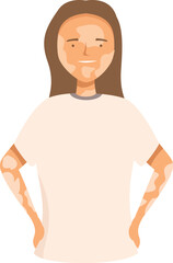 Young woman with vitiligo skin condition smiling and posing confidently