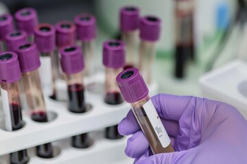 Influenza test to look for abnormalities from blood 