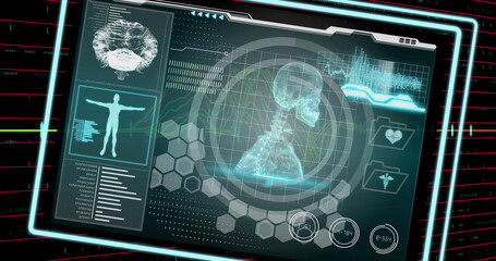 Image of medical data processing over financial data processing on black background