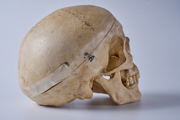 Adult male skull on a white background.