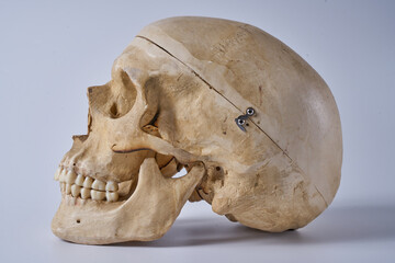 Adult male skull on a white background.