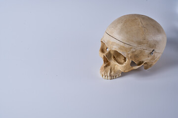 Adult male skull on a white background.