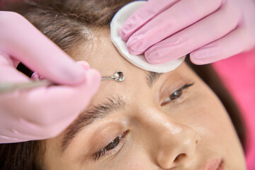Fototapeta premium Young woman getting mechanical comedo extraction performed by professional