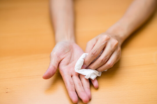 Woman suffer from hand perspiration clean up with tissue