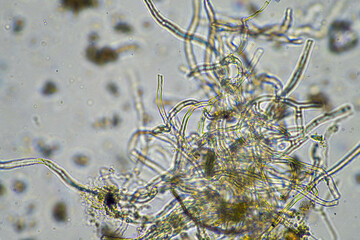 compost microorganisms under a microscope including amoeba, flagellates, nematodes, fungi, bacteria...