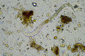 ‘soil microorganisms under a microscope including amoeba, flagellates, nematodes, fungi, bacteria from a healthy forest bush national park research by a university