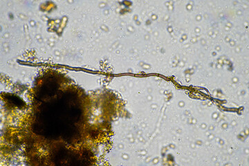 microorganisms and soil biology, with nematodes and fungi under the microscope. in a soil and compost sample on a farm