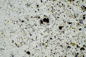 microorganisms under a microscope including amoeba, flagellates, nematodes, fungi, bacteria, viruses and diseases of animal and human health
