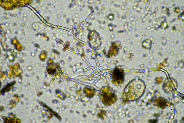 soil microorganisms under a microscope including amoeba, flagellates, nematodes, fungi, bacteria,...