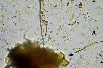 Soil under the microscopy, looking at sand, silt and clay and soil biology, amoebae, fungi, fungal,...