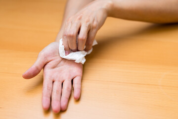 Woman suffer from hand perspiration clean up with tissue