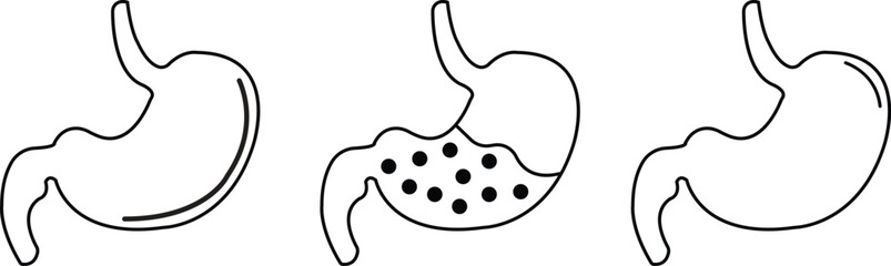 Set of Digestive system anatomy. Black colors Stomach gastric icons. Human internal organs symbols. Stomach oncology procedure signs in line styles editable stock isolated on transparent background.