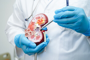 Chronic kidney disease, doctor with model for treatment urinary system, urology, Estimated...