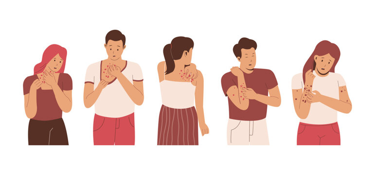 Collection people scratching body, rash, allergy on skin. Illustration for websites, landing pages, mobile applications, posters and banners. Trendy flat vector illustration
