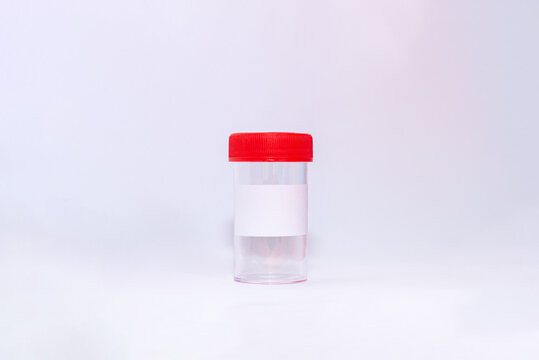 Flacon d'&eacute;chantillon &agrave; urine, flacon de laboratoire, r&eacute;cipient d'urine, analyses