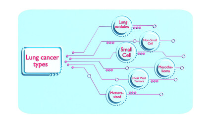 3D Cancer Cell Infographic, Lung Cancer Cells types in 3D style,  Tumor microenvironment explainer with types, Cancer Treatment 3D, Cancer therapy lung nodules 3d rendering