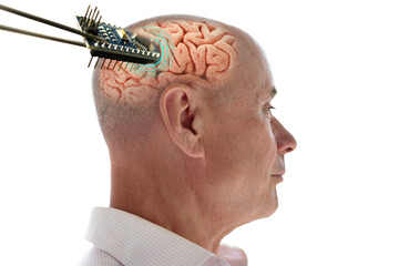 Installing electronic chip into human brain, applied in various fields neurotechnology and medical...