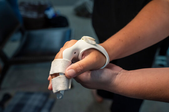 orth&egrave;se thermoform&eacute;e pour consolidation de fracture	