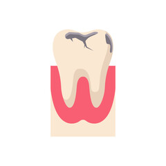 Healthy and sick teeth in the mouth on the gum. Dirty and clean. Two teeth cartoon characters icons. Healthy white teeth and with a hole. Vector illustration flat design. Isolated on white background.