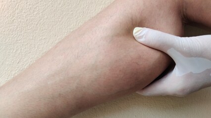 close up the hand squeeze the calf, problem circulation of blood, varicose veins and spider on the leg of the woman, health care and beauty concept.