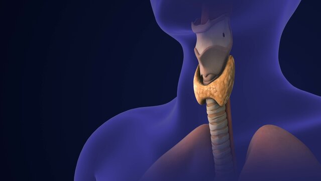 Medical concept of Thyroid gland cancer