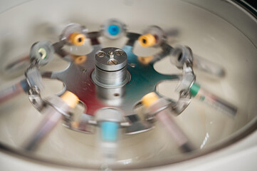  Container for tubes of biochemical analyzers Doctor removes from lab centrifuge. Platelet-Rich...