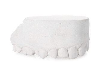 Dental model with gum isolated on white. Cast of teeth