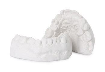 Dental model with gums isolated on white. Cast of teeth