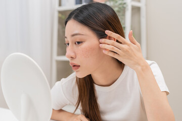 Dermatology, expression face worry asian young woman looking mirror hand touch face at dark spot of melasma, freckle from pigment melanin, allergy sun. Beauty care, skin problem treatment, acne care.