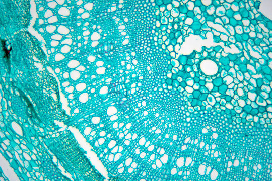 Caulis Sinomenii stem plant cells micrograph